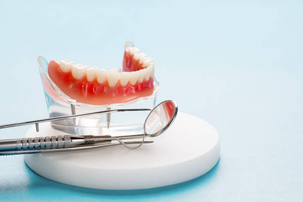 Dental Bonding in Chandler, AZ