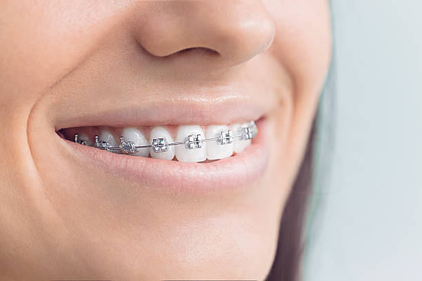 Best Teeth Whitening  in Chandler, AZ